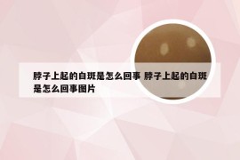 脖子上起的白斑是怎么回事 脖子上起的白斑是怎么回事图片