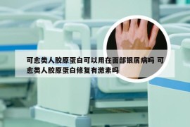 可愈类人胶原蛋白可以用在面部银屑病吗 可愈类人胶原蛋白修复有激素吗