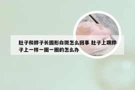 肚子和脖子长圆形白斑怎么回事 肚子上跟脖子上一样一圈一圈的怎么办