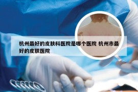 杭州最好的皮肤科医院是哪个医院 杭州市最好的皮肤医院