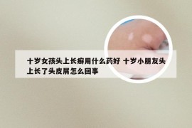 十岁女孩头上长癣用什么药好 十岁小朋友头上长了头皮屑怎么回事