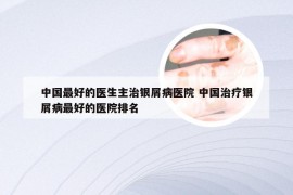 中国最好的医生主治银屑病医院 中国治疗银屑病最好的医院排名