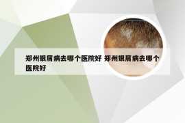 郑州银屑病去哪个医院好 郑州银屑病去哪个医院好