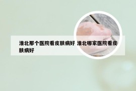 淮北那个医院看皮肤病好 淮北哪家医院看皮肤病好