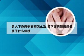 男人下身两侧宥癣怎么冶 男下面两侧瘙痒是属于什么症状