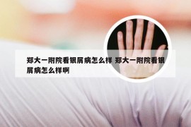 郑大一附院看银屑病怎么样 郑大一附院看银屑病怎么样啊