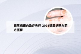 银屑病靶向治疗先行 2021银屑病靶向药进医保