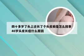 四十多岁了头上还长了个头皮癣是怎么回事 40岁头皮长痘什么原因