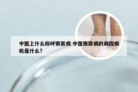 中医上什么称呼银屑病 中医银屑病的病因病机是什么?