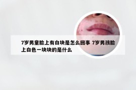 7岁男童脸上有白块是怎么回事 7岁男孩脸上白色一块块的是什么