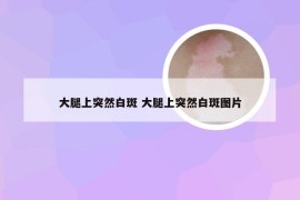 大腿上突然白斑 大腿上突然白斑图片