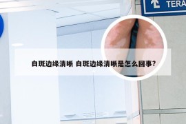 白斑边缘清晰 白斑边缘清晰是怎么回事?