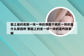 腿上面的皮肤一块一块的像那个鳞片一样的是什么原因啊 那腿上的皮一块一块的是咋回事呢