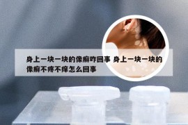 身上一块一块的像癣咋回事 身上一块一块的像癣不疼不痒怎么回事