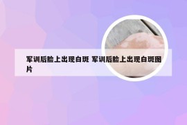 军训后脸上出现白斑 军训后脸上出现白斑图片