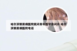 哈尔滨银屑病医院就问青年医学会问诊 哈尔滨银屑病医院电话