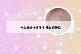 什么癣能快速传播 什么癣传染