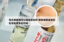 龟头银屑病可以用卤米松吗 银屑病用卤米松乳膏能用多长时间