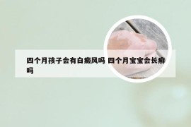 四个月孩子会有白癜风吗 四个月宝宝会长癣吗