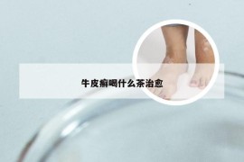 牛皮癣喝什么茶治愈