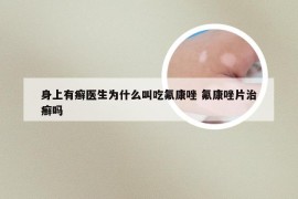 身上有癣医生为什么叫吃氟康唑 氟康唑片治癣吗