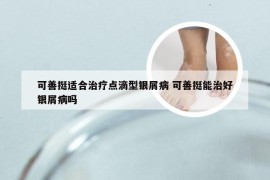 可善挺适合治疗点滴型银屑病 可善挺能治好银屑病吗