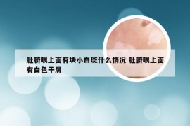 肚脐眼上面有块小白斑什么情况 肚脐眼上面有白色干屑