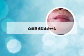 白癜风病禁止吃什么