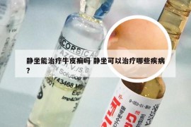 静坐能治疗牛皮癣吗 静坐可以治疗哪些疾病?