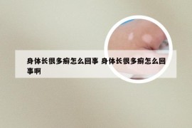 身体长很多癣怎么回事 身体长很多癣怎么回事啊