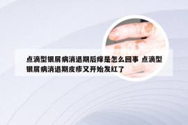 点滴型银屑病消退期后痒是怎么回事 点滴型银屑病消退期皮疹又开始发红了