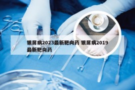 银屑病2023最新靶向药 银屑病2019最新靶向药