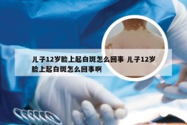 儿子12岁脸上起白斑怎么回事 儿子12岁脸上起白斑怎么回事啊