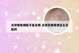 点状银屑病能不能去根 点状型银屑病怎么引起的