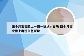 四个月宝宝脸上一圈一块块小白块 四个月宝宝脸上出现白色斑块