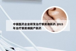 中国医药企业研发治疗银屑病新药 2021年治疗银屑病国产新药