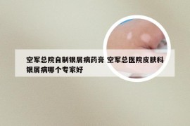 空军总院自制银屑病药膏 空军总医院皮肤科银屑病哪个专家好