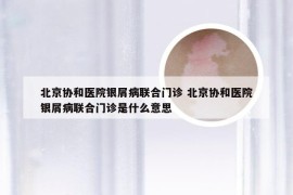 北京协和医院银屑病联合门诊 北京协和医院银屑病联合门诊是什么意思