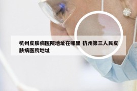 杭州皮肤病医院地址在哪里 杭州第三人民皮肤病医院地址