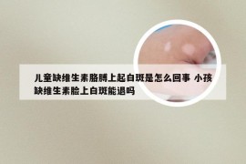 儿童缺维生素胳膊上起白斑是怎么回事 小孩缺维生素脸上白斑能退吗