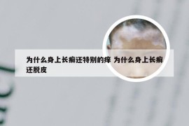 为什么身上长癣还特别的痒 为什么身上长癣还脱皮