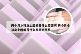 两个月小孩身上起癣是什么原因啊 两个月小孩身上起癣是什么原因啊图片