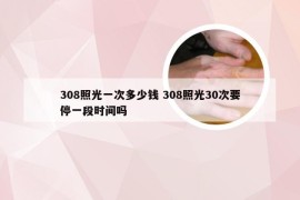 308照光一次多少钱 308照光30次要停一段时间吗