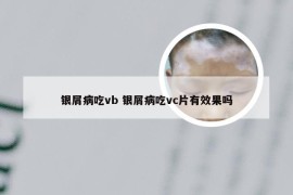 银屑病吃vb 银屑病吃vc片有效果吗