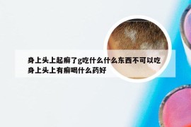 身上头上起癣了g吃什么什么东西不可以吃 身上头上有癣喝什么药好