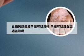 白癜风遮盖液孕妇可以用吗 孕妇可以用白斑遮盖液吗