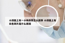 小孩腿上有一小块白斑怎么回事 小孩腿上有白色斑片是什么原因