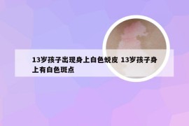 13岁孩子出现身上白色蜕皮 13岁孩子身上有白色斑点