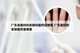 广东省最好的皮肤科医院在哪里 广东最好的皮肤医院是哪里