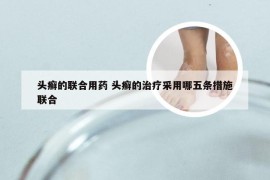 头癣的联合用药 头癣的治疗采用哪五条措施联合